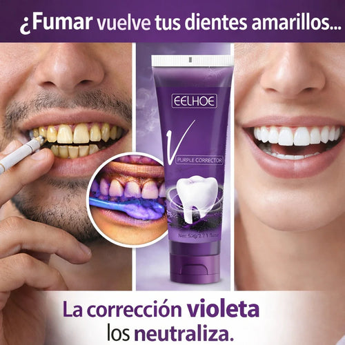 ¿Dientes más blancos sin químicos agresivos?