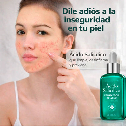 ¿Cansada de esconder tu piel con maquillaje?
