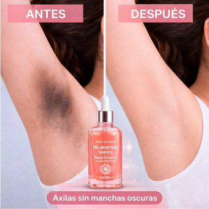 ¿Axilas oscuras después de rasurarte muchas veces?