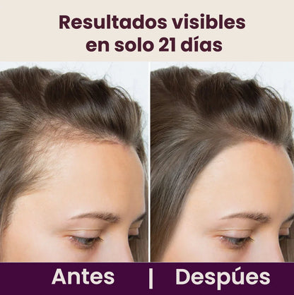 Estrés diario + mala Alimentación = 😖💥 cabello frágil.