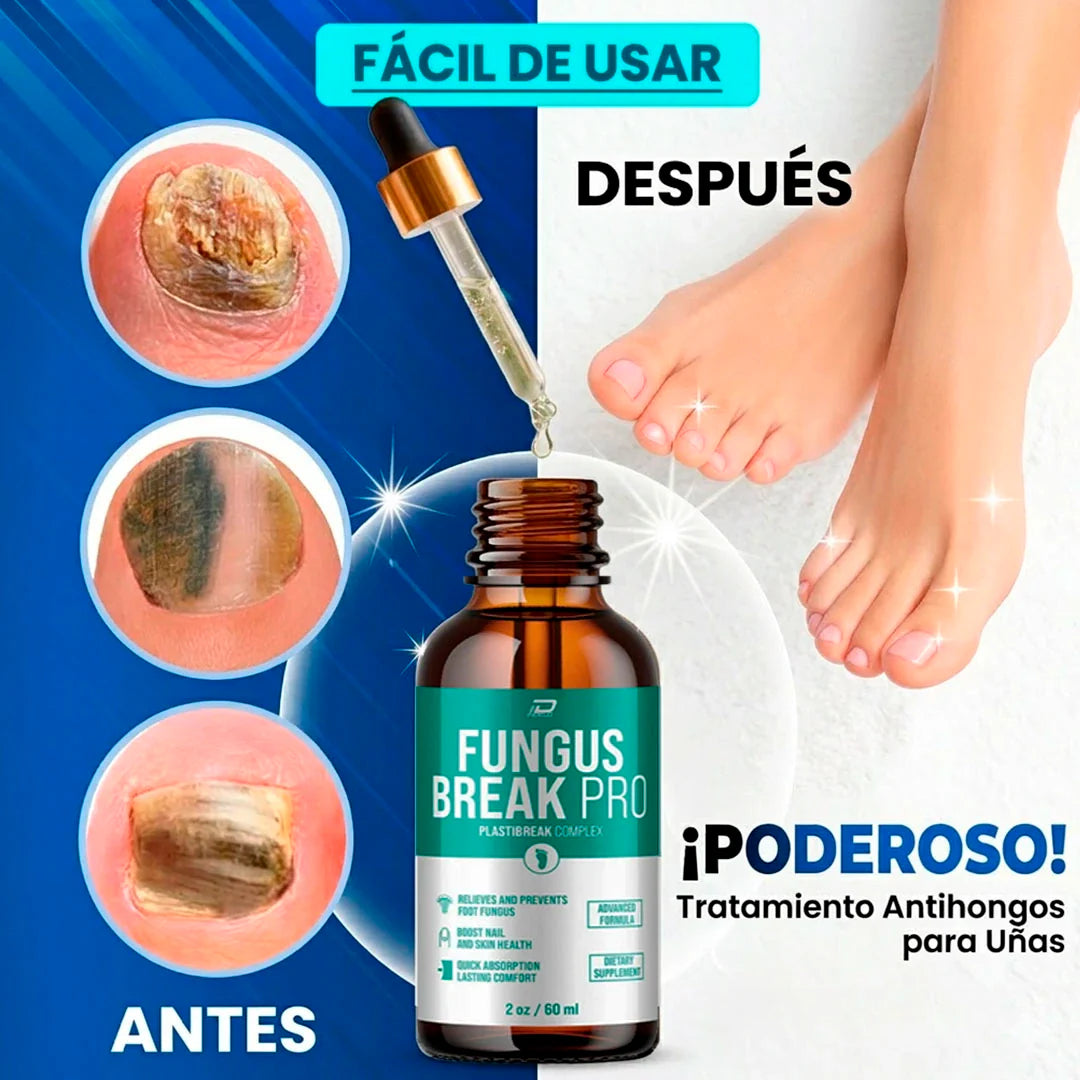 ¿Tienes hongos en los pies y no se te quitan?