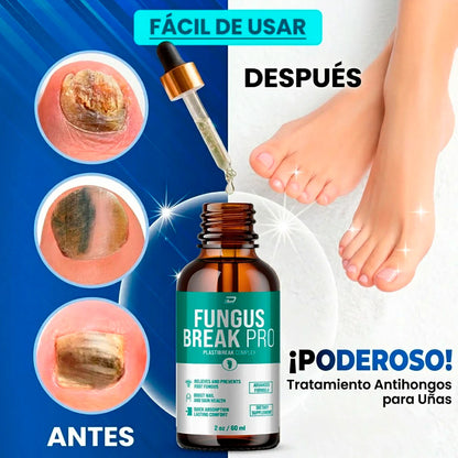 ¿Tienes hongos en los pies y no se te quitan?
