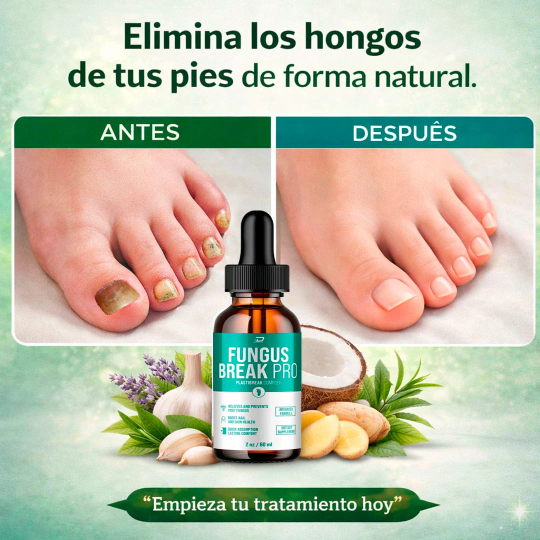 ¿Tienes hongos en los pies y no se te quitan?