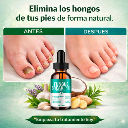 ¿Tienes hongos en los pies y no se te quitan?