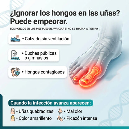¿Tienes hongos en los pies y no se te quitan?